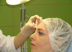 Микро-инъекции могут проводиться в различные зоны лица: углы глаз, лоб