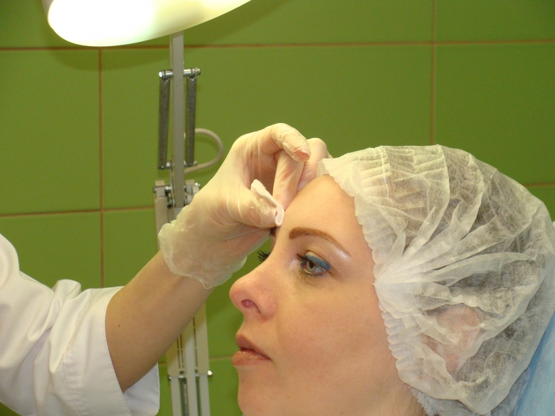 Микро-инъекции могут проводиться в различные зоны лица: углы глаз, лоб