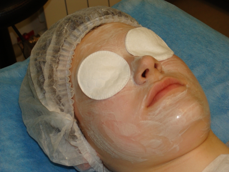 Далее – финальная маска, содержащая кислоты и ретинол. Она продолжает действие пилинга.